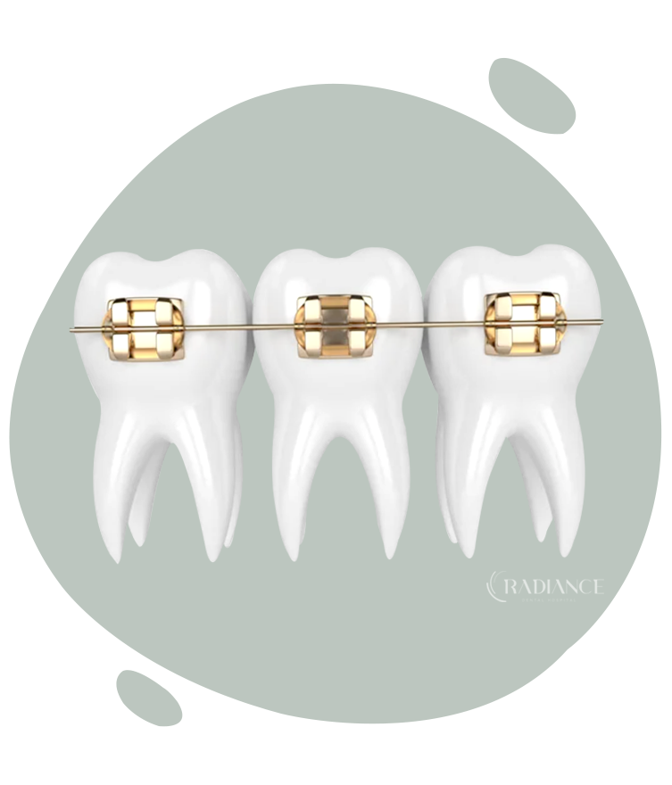 Sorrisi belli e sani con i trattamenti ortodontici di Radiance Dental Hospital.