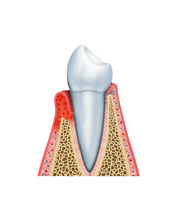 https://radiance.al/wp-content/uploads/2024/10/periodontics1-1.png